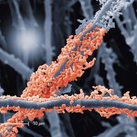 Die feinen Pilzfäden sind über und über von Bakterien besiedelt (rot eingefärbt). Das Bild zeigt einen Ausschnitt von etwa 50 mal 34 Mikrometern und stammt von einem Team um Anaële Simon von der Université de Neuchâtel